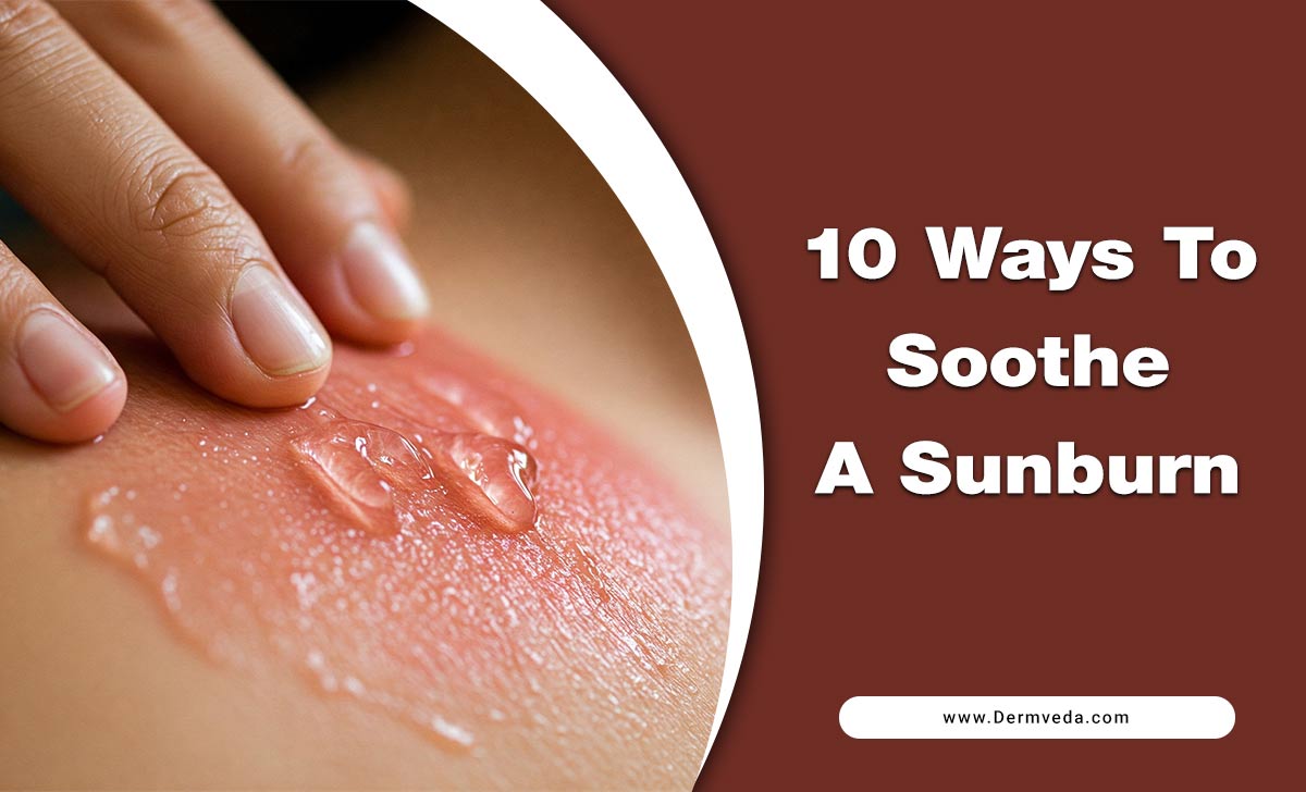 10 Ways to Soothe a Sunburn