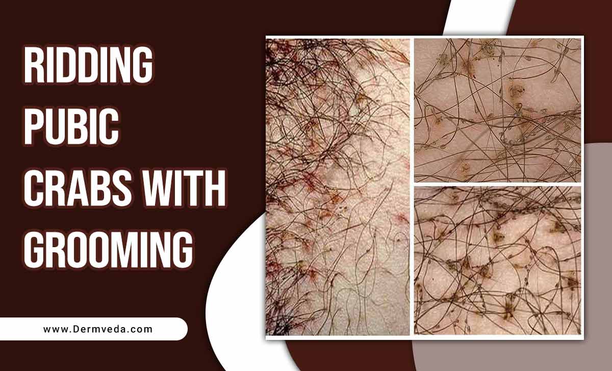 Ridding Pubic Crabs With Grooming