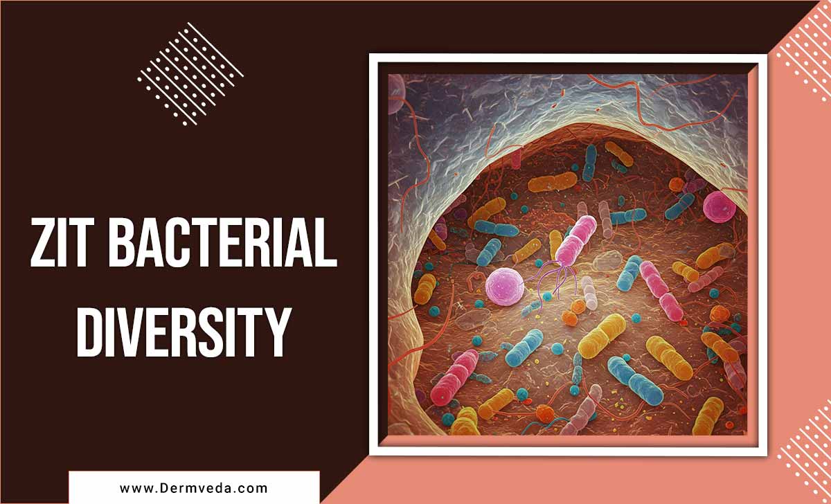 Zit bacterial diversity