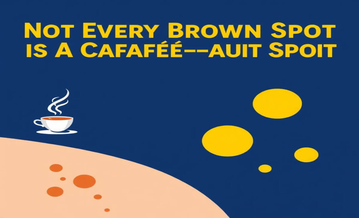 Not Every Brown Spot Is A Café-Au-Lait Spot