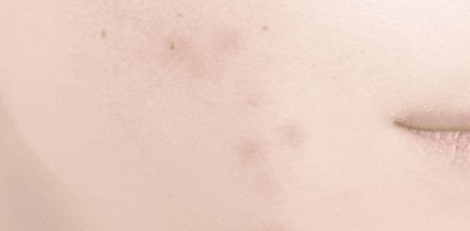 emotional triggers acne plan emotional triggers acne plan