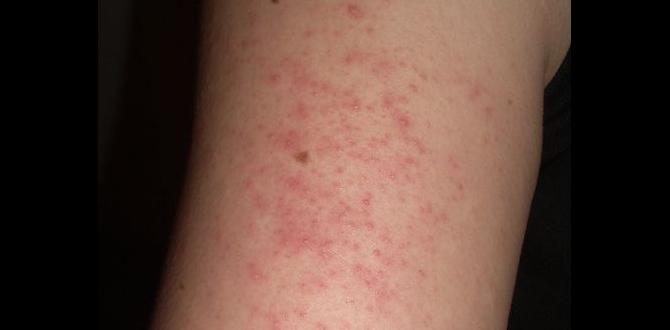 plan in anxiety rash causes plan in anxiety rash causes
