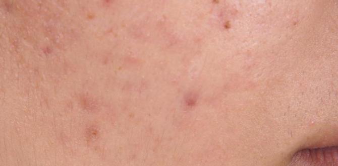 Acne triggers for combination skin safe combination skin routine for acne Acne triggers for combination skin safe combination skin routine for acne