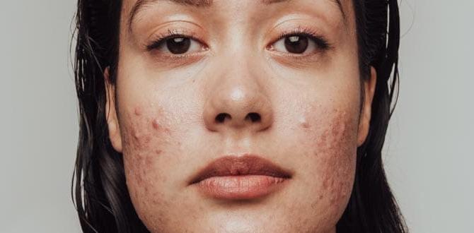 Understanding acne: causes and types monthly skin routine for acne after shower Understanding acne: causes and types monthly skin routine for acne after shower