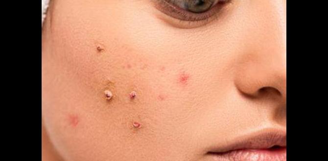 Understanding acne: causes and types safe simple skin care routine for acne Understanding acne: causes and types safe simple skin care routine for acne
