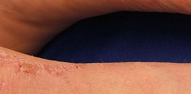 eczema behind ears