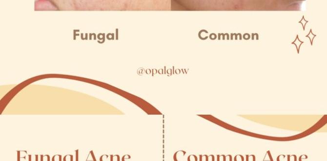 fungal acne vs regular acne fungal acne vs regular acne