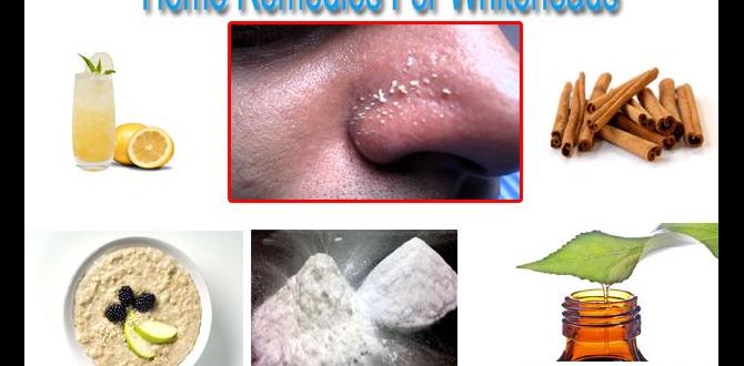 guide to whiteheads remedies guide to whiteheads remedies