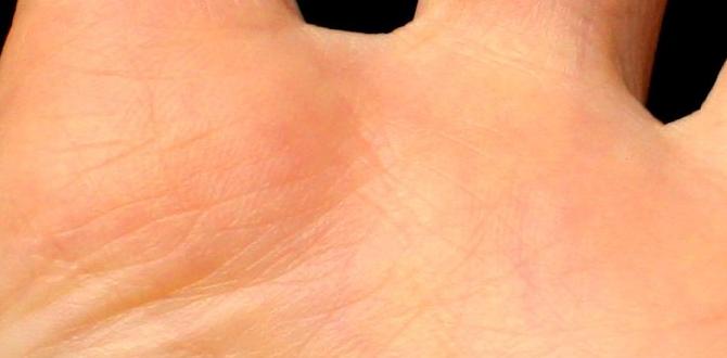 hand skin conditions pictures hand skin conditions pictures