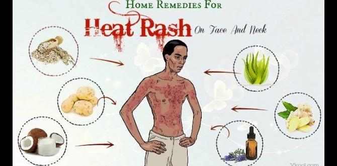 heat rash home remedies heat rash home remedies