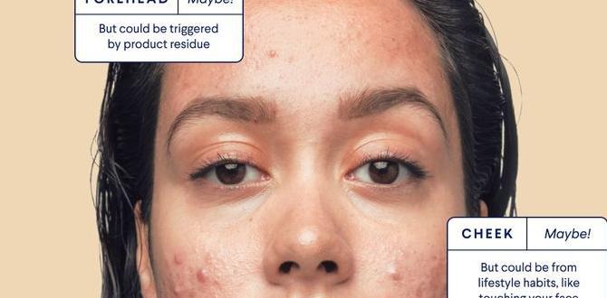 hormone detox for acne hormone detox for acne