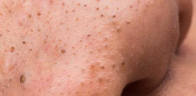 how to blackheads remedies how to blackheads remedies