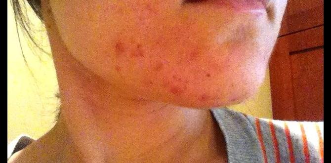 improve skin microbiome oil improve skin microbiome oil