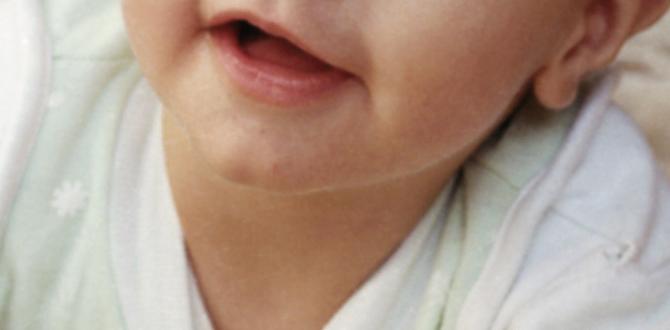 infant skin conditions infant skin conditions