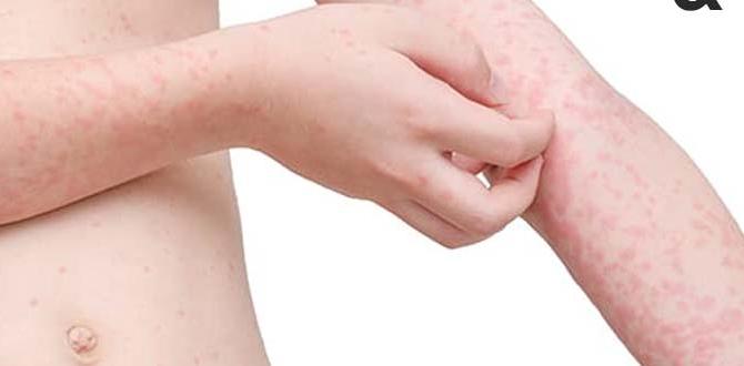 juvenile skin conditions juvenile skin conditions