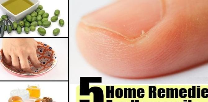 natural remedies for hangnails natural remedies for hangnails