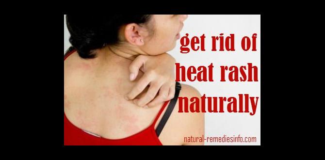 natural remedies for heat rash natural remedies for heat rash