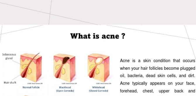 organic skin routine for acne pdf organic skin routine for acne pdf