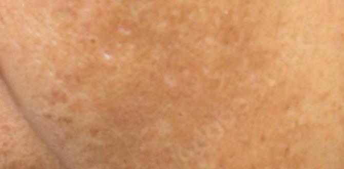 pigmentation removal remedies at home pigmentation removal remedies at home