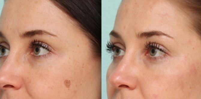 pigmentation removal remedies for dark spots pigmentation removal remedies for dark spots
