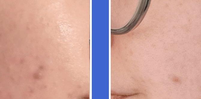 probiotics for clear skin probiotics for clear skin