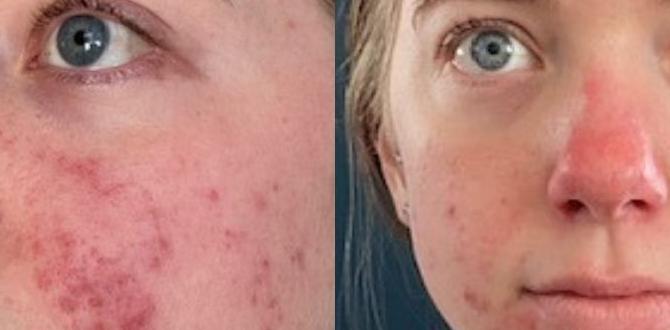 protect skin microbiome eczema protect skin microbiome eczema