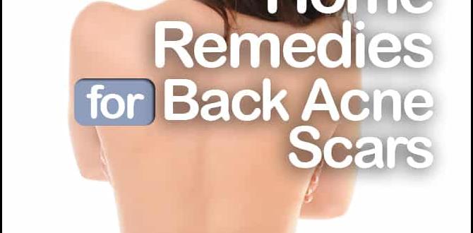 remedies for back acne scars remedies for back acne scars