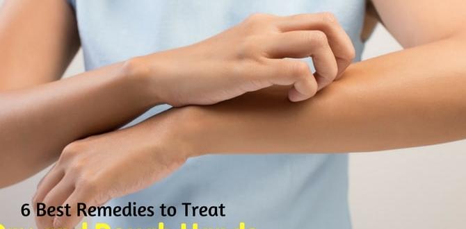 remedies for rough hands remedies for rough hands