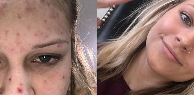 simple step by step skin care for acne simple step by step skin care for acne