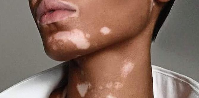vitiligo makeup products vitiligo makeup products