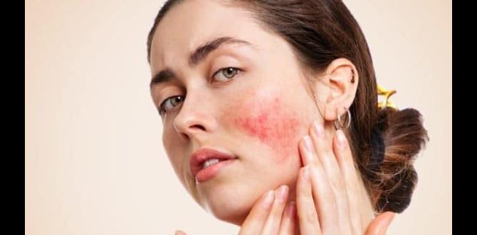 xmas skin conditions xmas skin conditions