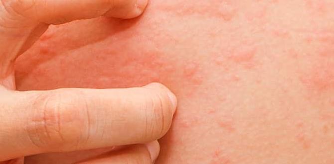 zinc for skin conditions zinc for skin conditions